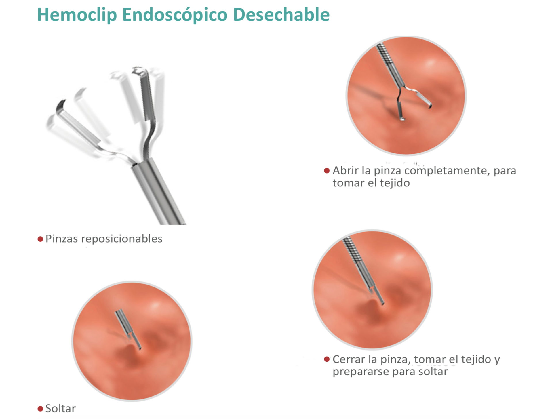 Hemoclip Endoscópico Desechable